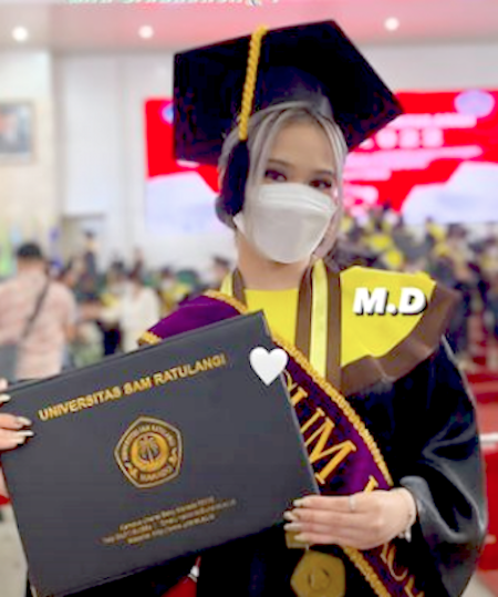 Satu Lagi Milenia Hebat Indonesia, Angela Lulus Dokter di Usia Akhir Kepala 1